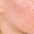 คนขายเครื่องสำอาง  จะจัดการปัญหาลูกค้าแพ้เครื่องสำอางได้อย่างไร?